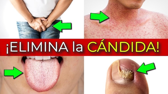 Candida Cleanse Capsulas