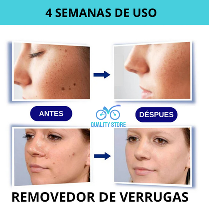 Crema Quita Verrugas Wart Remover