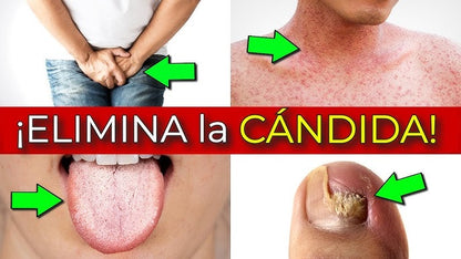 Candida Cleanse Capsulas
